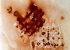 andere_techniken-index015004.jpg